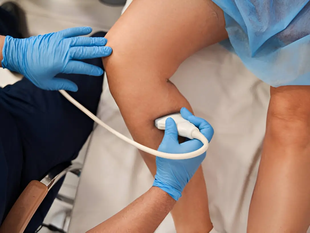 Ultrassom Doppler Vascular